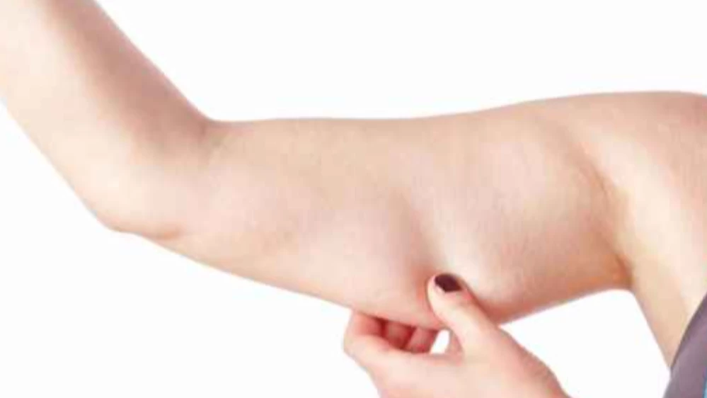 Kol sarkmaları neden olur